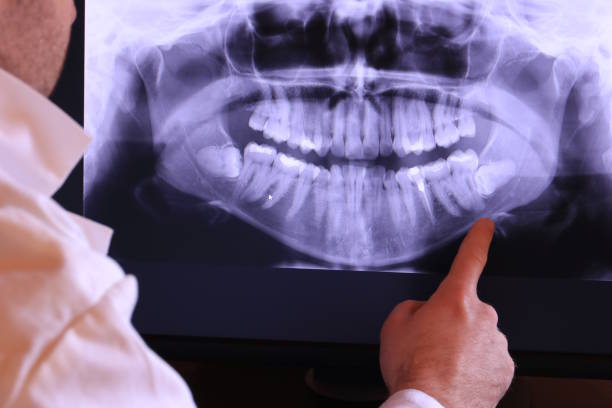 Best Emergency Tooth Extraction in Shenandoah, PA